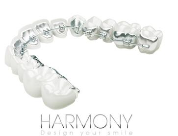 Harmony is a unique, invisible, lingual braces system.