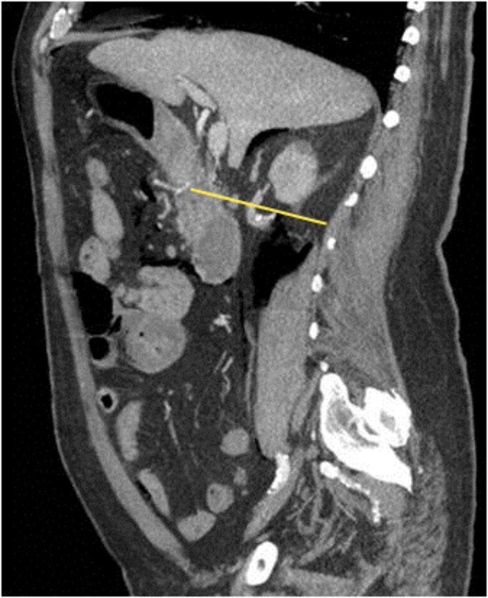 Fig. 14: CT angiography, sagittal.
