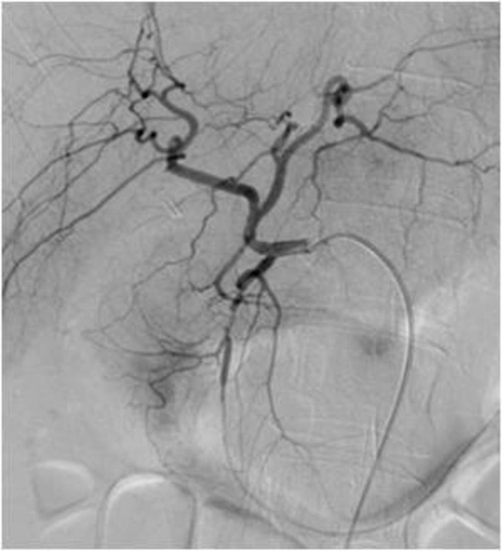 Fig. 31: Angiography showing