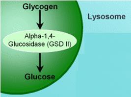 Pompe disease Lysosomes become engorged with glycogen because they lack α-1,4-glucosidase, a