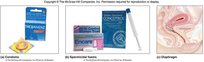 Birth control Condoms and other barrier methods