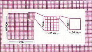Standardized Methods & Devices ECG Graph Paper Vertical axis - voltage 1 small box = 1 mm = 0.