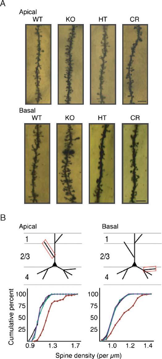 OGREN AND LOMBROSO Fig. 1 Genetic rescue of dendritic spine phenotype in fragile X syndrome.