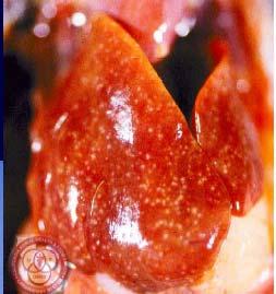 Postmortem lesions 1. Peracute disease produces no lesions. 2. Hemorrhage on heart and fat (figure 11.