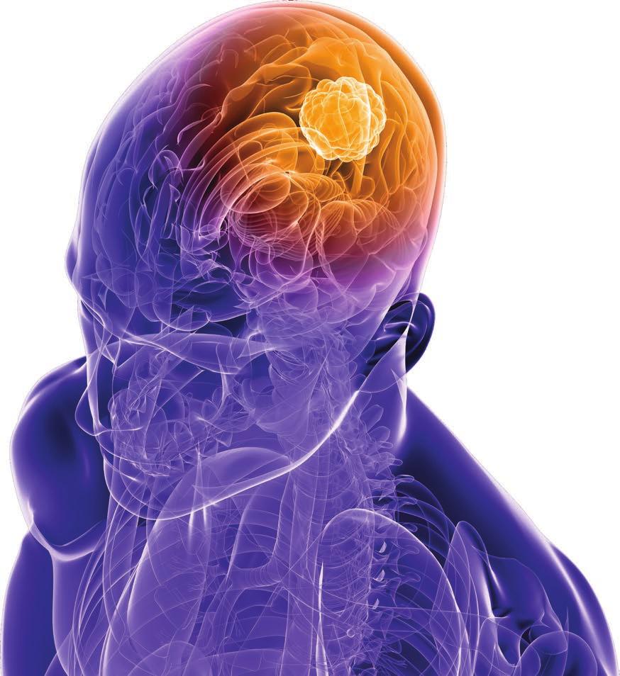 The 2016 Northwestern Brain Tumor