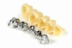 INFORMATION FOR DENTAL TECHNICIANS Metal-supported long-term temporary restorations For stability reasons, fixed long-term temporary restorations are often equipped with a metal core
