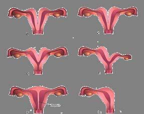 uterine and vaginal