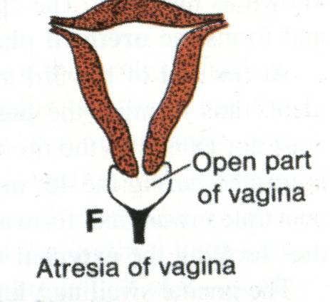 vagina & uterus