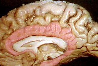 Amygdala Amygdala and hippocampus are part of the limbic system, an area on the border (limbus) between cortex (perceptual processes) and hypothalamus (visceral control), integrating