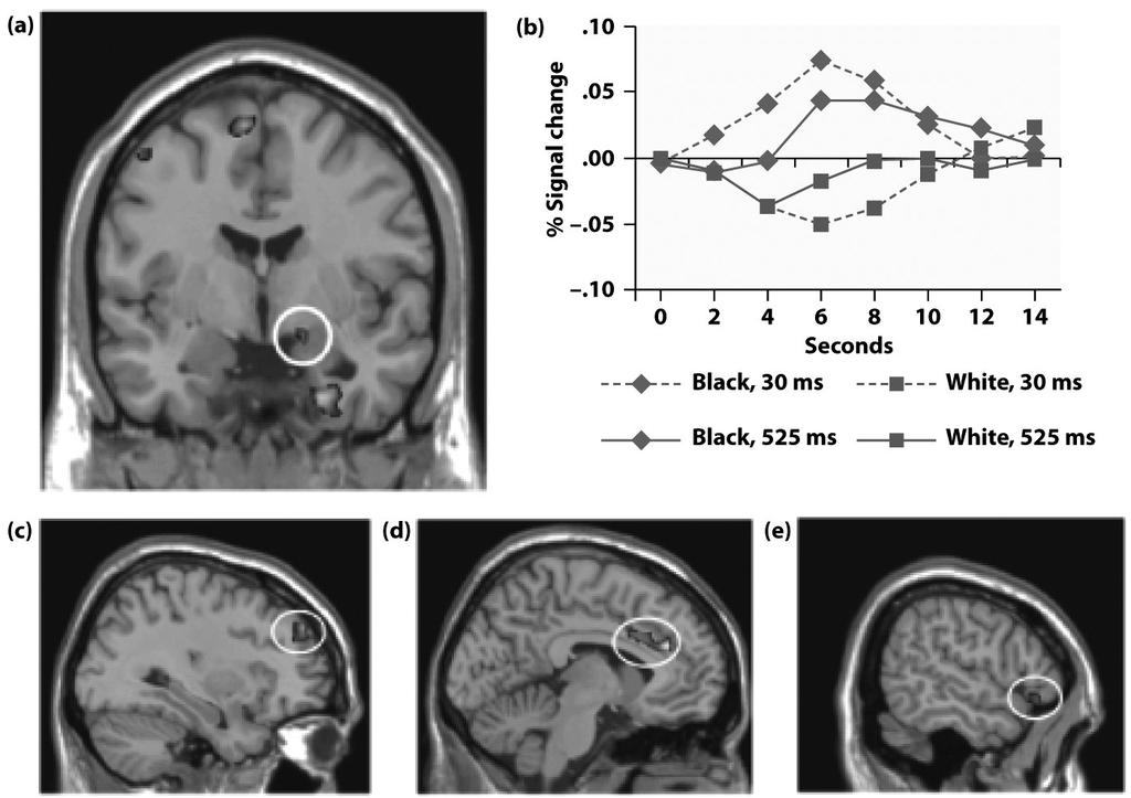 viewed black unfamiliar faces; BUT: SP showed equal bias in spite of amygdala lesions