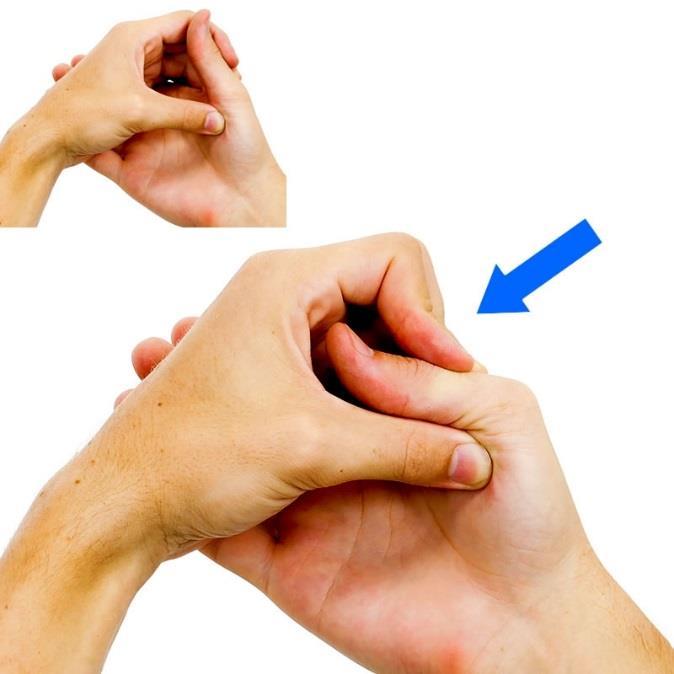 Thumb MCP Flexion Stretch Grasp the target thumb with the opposite hand as shown.