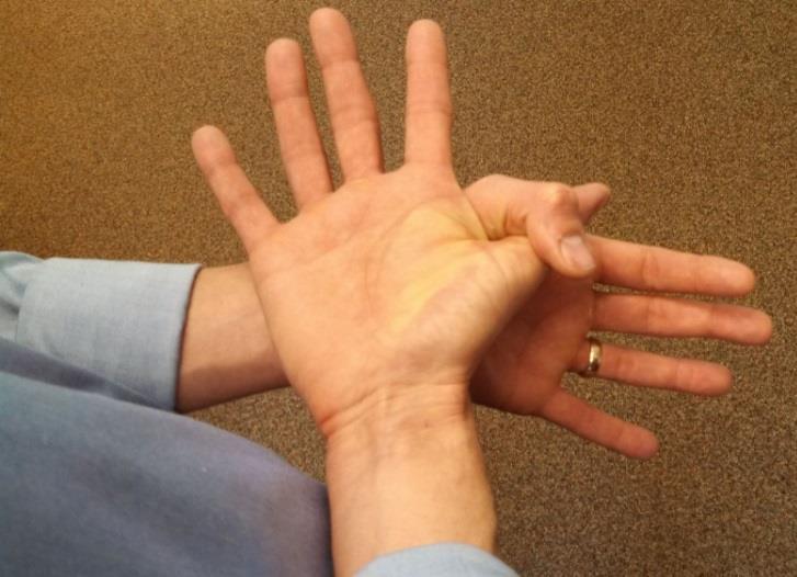 Carpal Tunnel Stretch Position the hand with the palm up and pinky facing your trunk.