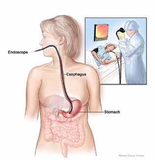 Having a Gastroscopy Gastroenterology Department Patient Information Leaflet Options available If you d like a large print, audio,