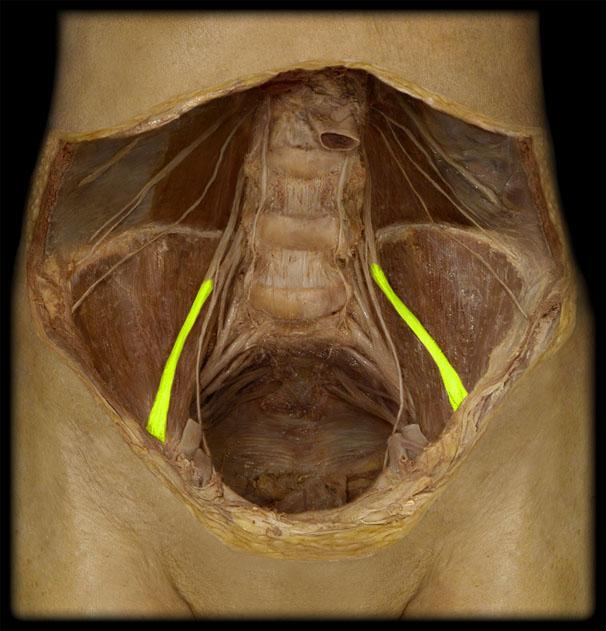 Lacuna musculonervosa Iliopsoas muscle Femoral nerve (L2-4) Lateral