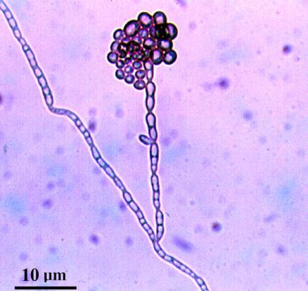 Human and animal diseases Black moulds (dark-walled septate) Xylohypha bantiana