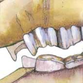 Resulting Problems - prevents horse from chewing freely side to side resulting improper and excessive molar wear. Tight soft tissues are very susceptible to lacerations from sharp molar points.