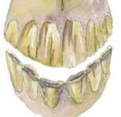 VENTRAL CURVATURE (Smile) Definition - Outer corner lower incisors grow longer relative to outer corner upper incisors.