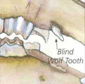 Can fracture or become loose causing discomfort Solution - Wolf teeth should be removed before horse starts being bitted to prevent discomfort and bad habits.