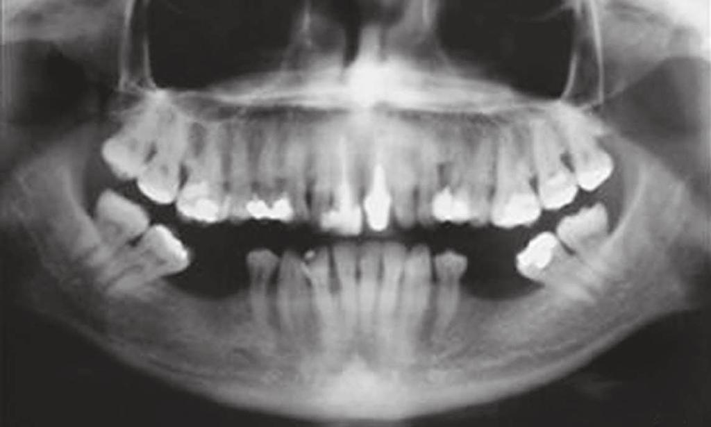 images showing the clinical case with molar