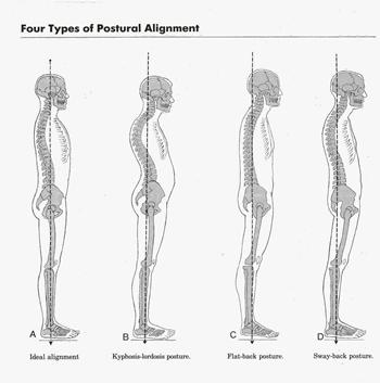 Back Pain Posture is key Proper alignment of the spine in all positions Caution with bending and twisting of the back Avoid prolonged periods in any position STRESS