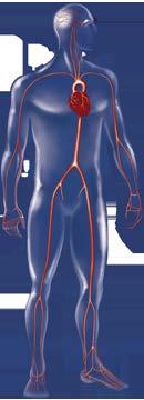 Atherothrombosis Can Manifest in Multiple Vascular Beds