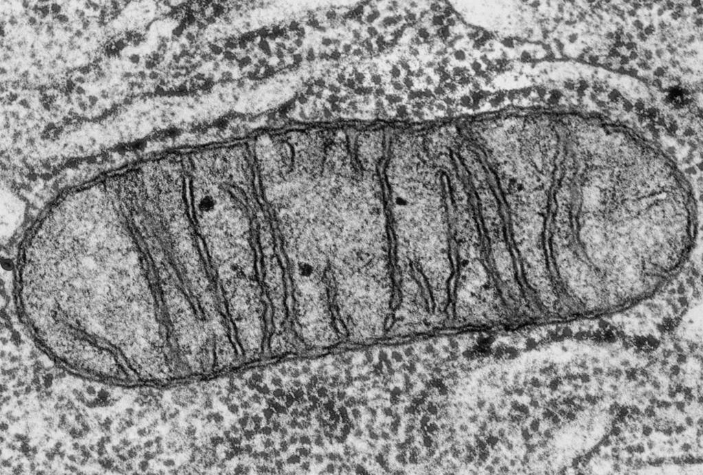 (b) Fig. 1.2 shows an electron micrograph of a mitochondrion. 3 Fig. 1.2 Mitochondria have two membranes, an inner membrane and an outer membrane.
