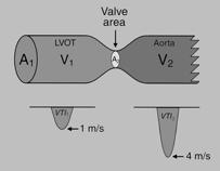 by Continuity Equation LVOT Shape:
