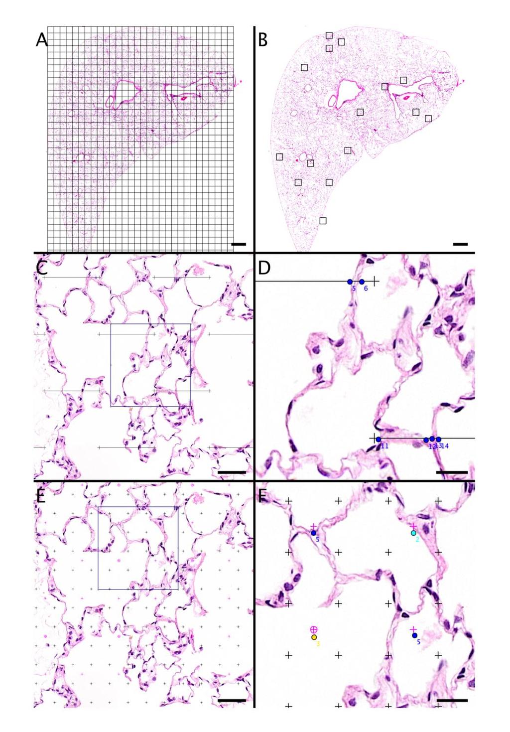 fig. S9. Outline of stereologic analysis. (A) Lung section divided into grid of square fields. (B) Random fields selected for analysis. (C) Random field with line grid for surface measurements.