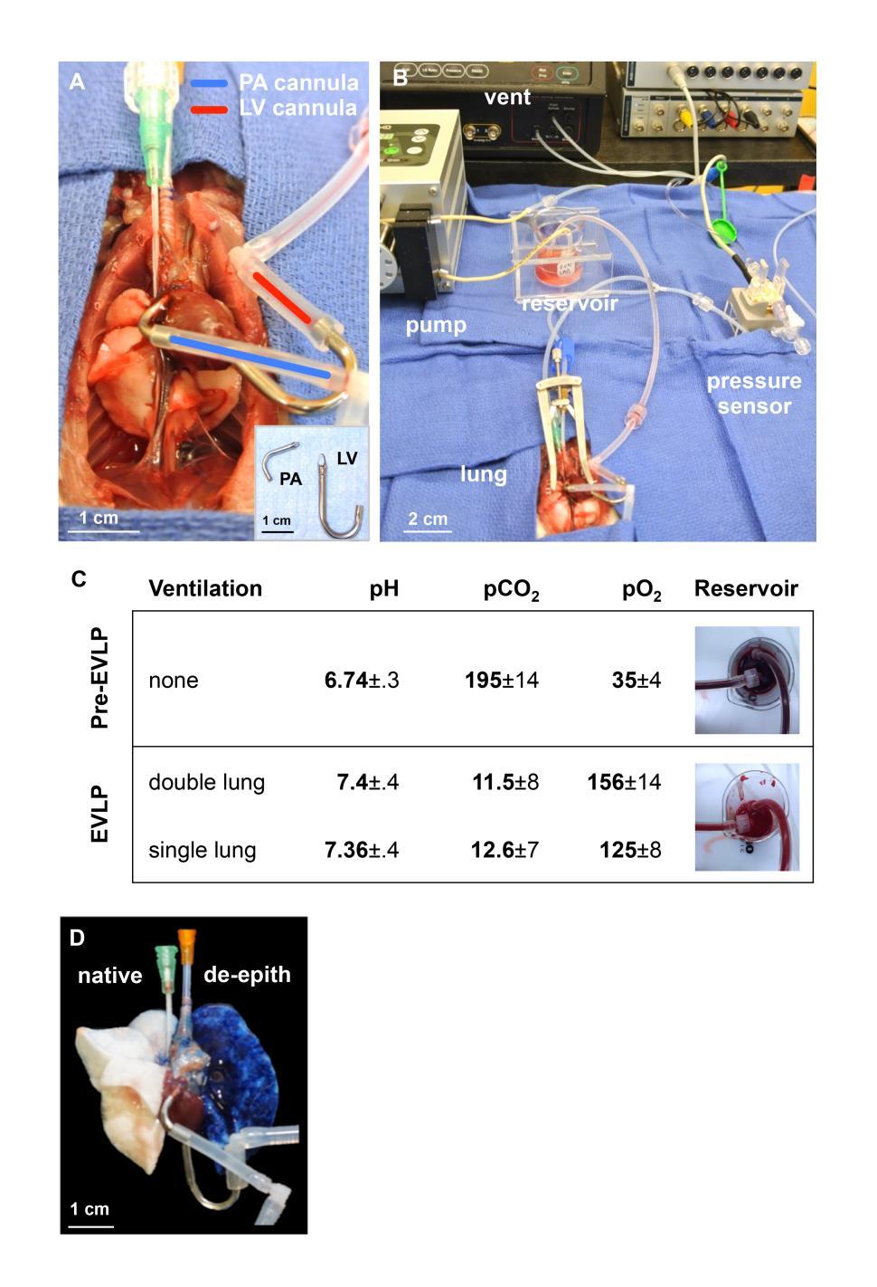fig. S1. Lung de-epithelialization. (A) Double lung cannulation demonstrating Pulmonary Artery (PA) cannula (blue) and Left Ventricle (LV) cannula (red).