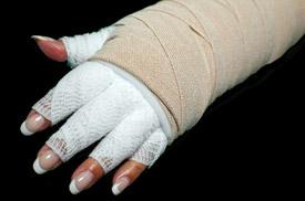 Compression Bandaging In order to prevent the swelling from