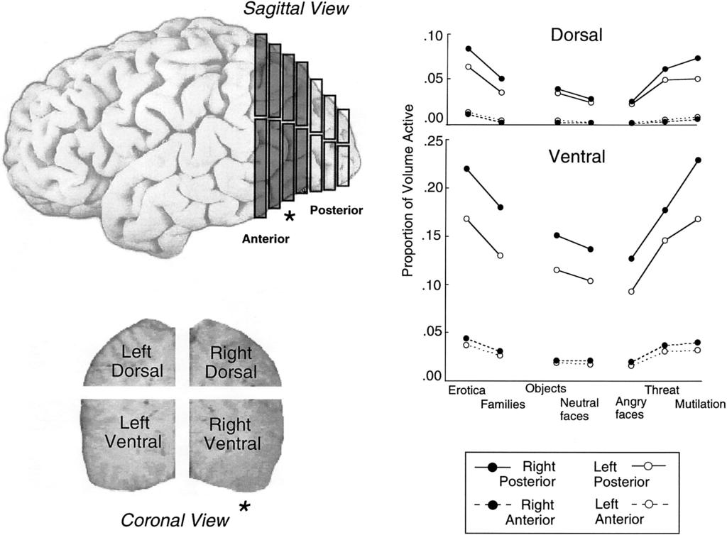 EMOTIONAL ACTIVATION IN VISUAL CORTEX 371 Figure 1. Top left: Sagittal view illustrating the slice selection and the dorsal and ventral regions in each of the anterior and posterior regions.