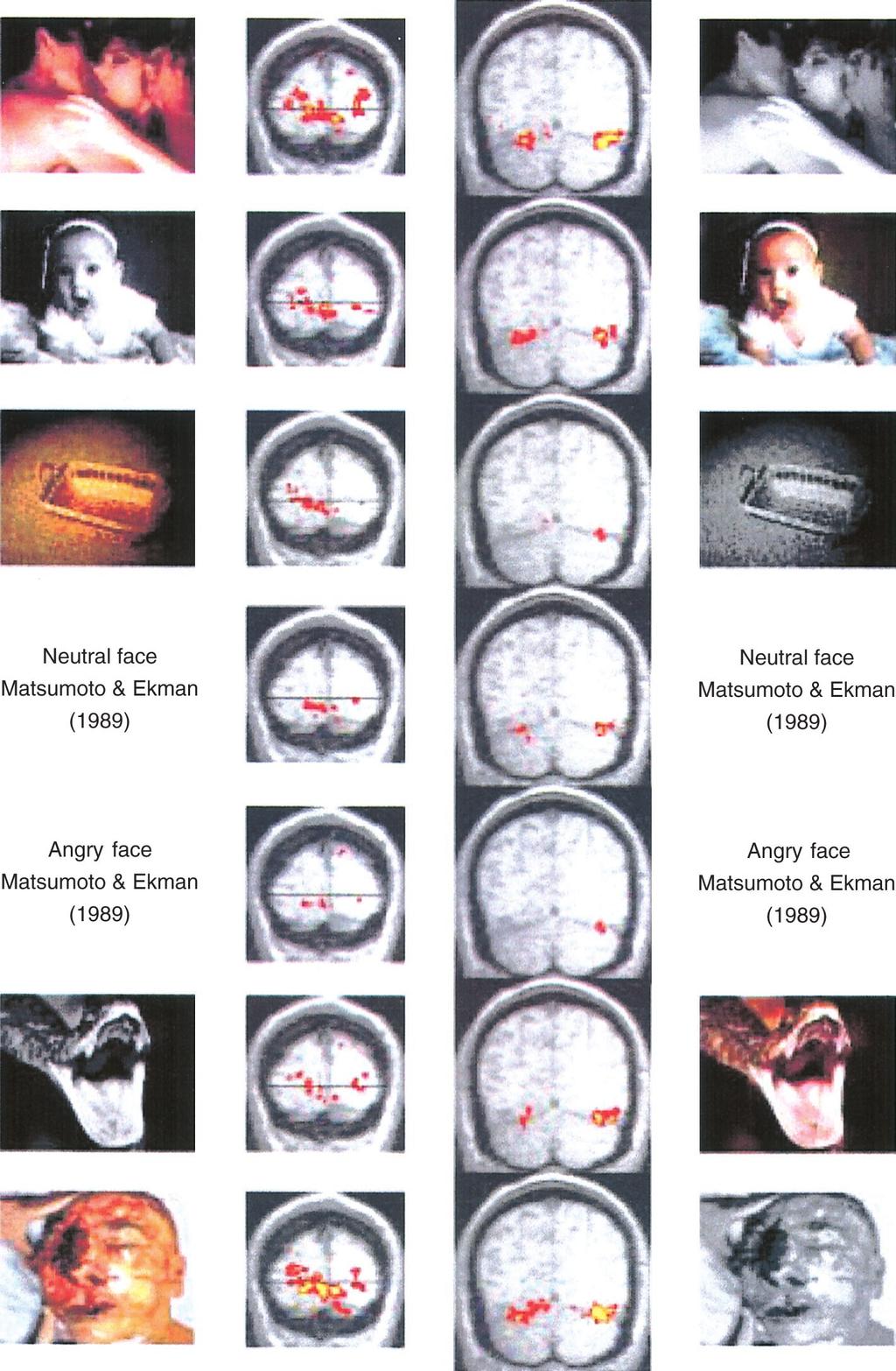 EMOTIONAL ACTIVATION IN VISUAL CORTEX 377 Figure 3.