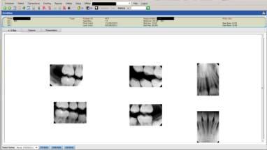 Some sample photographs and screen captures from a cloud based electronic record system called Denticon, which was used in this demonstration, are presented in