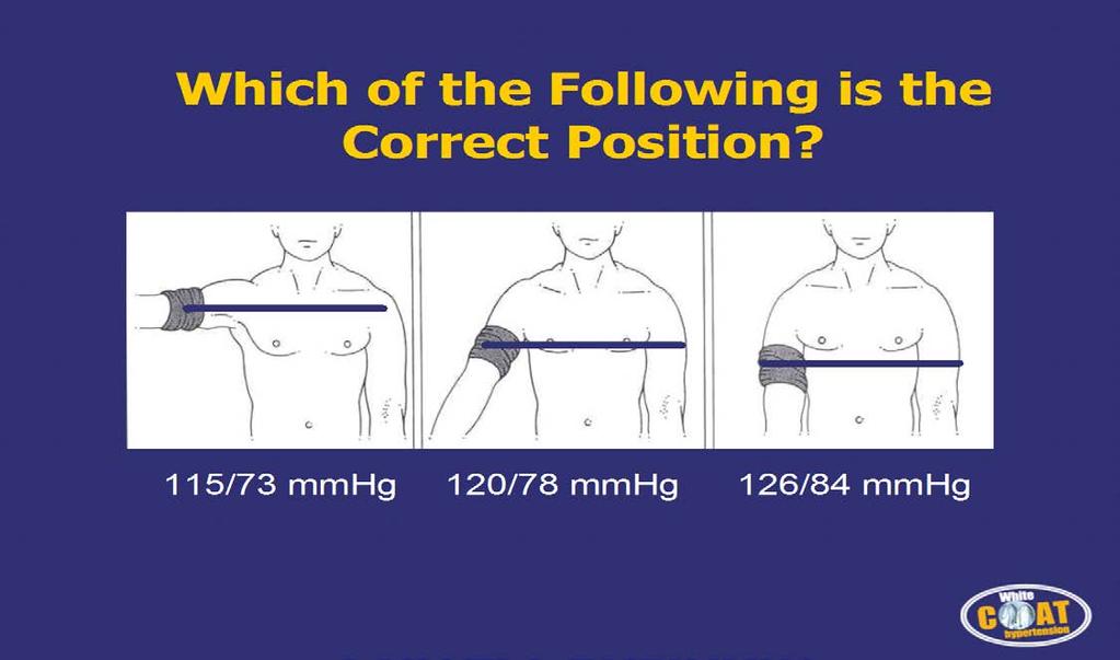 Positioning the Cuff The BP measurement will increase