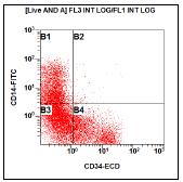 Initial - Flow Cytometry Blasts comprise 88% of non-erythroid marrow elements, expressing: CD34 (subset) HLA-DR CD33 CD13 CD14 (variable) CD64 CD38 CD4 CD25 (dim) CD123 cmpo