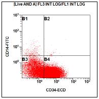Follow-up - Flow Cytometry Blasts comprise 79% of non-erythroid marrow elements, expressing: CD34 (dim) CD117 (dim) HLA-DR CD33 (dim) CD13