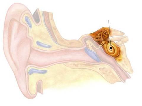 What are the types of hearing loss and Can it be cured?