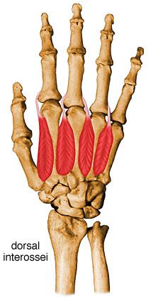 O I Dorsal Interossei 1 st lateral head ulnar side of 1 st metacarpal bone 1 st medial head radial side of 2 nd metacarpal bone 2 nd, 3 rd, 4 th space between metacarpal