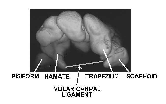 Carpometacarpal (CMC) Joints