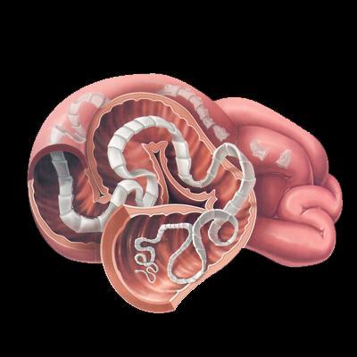 Issue 05 This article is about: Career Guidance Interesting Science Real Life Application Real Time News about Science Tapeworms Ever heard someone say, "He's so skinny he must have a tapeworm"?
