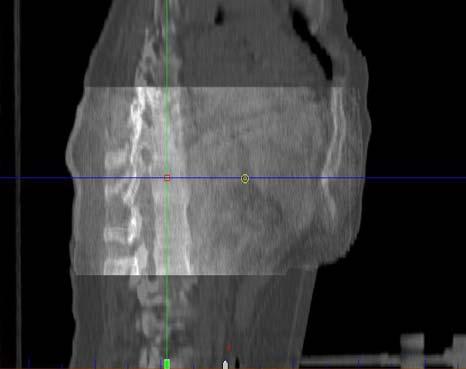 (CBCT and