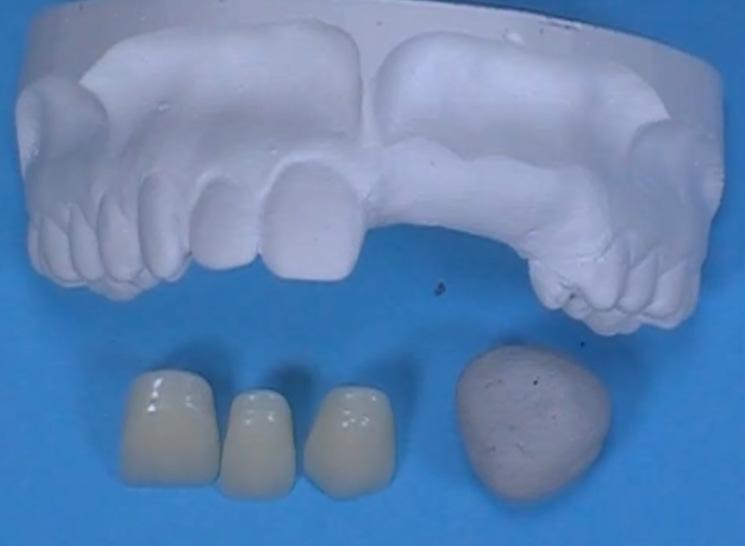 Items featured in this technique are found at the end of the procedure.