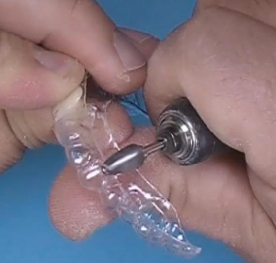 carbide taper bur in a lab handpiece.