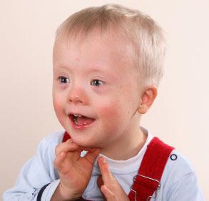 are due to typical trisomy