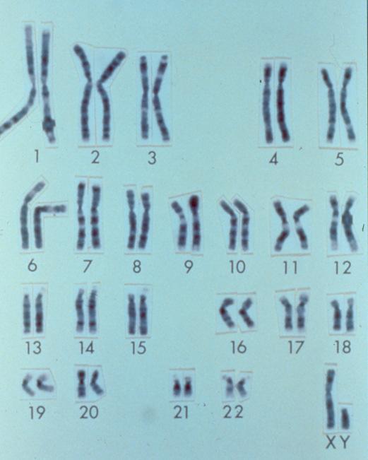 Normal Chromosome Pattern in Males Phenotype Physical traits that make up an individual Includes physical