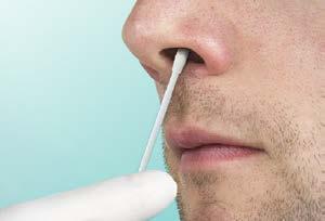 UPPER RESPIRATORY SPECIMENS Anterior Nares General use Culture swab Method of Collection Epic Test Name Acceptable