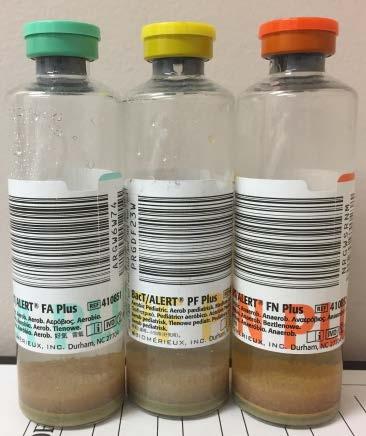 If <5mL volume, use pediatric (yellow) bottle 5-10mL of synovial or peritoneal fluid inoculated into aerobic (green) blood culture bottle. If <5mL volume, use pediatric (yellow) bottle.