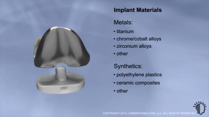 Implant Materials & Design A wide variety of knee replacement implant designs exist.