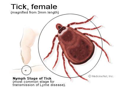 Leading tick-borne disease in the US Leading tick borne disease in the US CT, DE, MA, MD, MN, NJ, NY, PA, RI and WI have the highest rate Types of ticks that carry lyme disease Deer tick Size of a