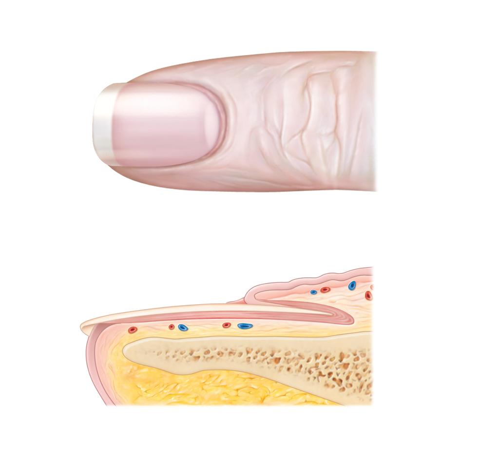 Structure of a Nail Lateral nail fold Lunule modifica=on of the epidermis on the distal, dorsal surface of fingers and toes (a) Free edge Body of nail of nail Nail bed Eponychium (cuticle) Proximal